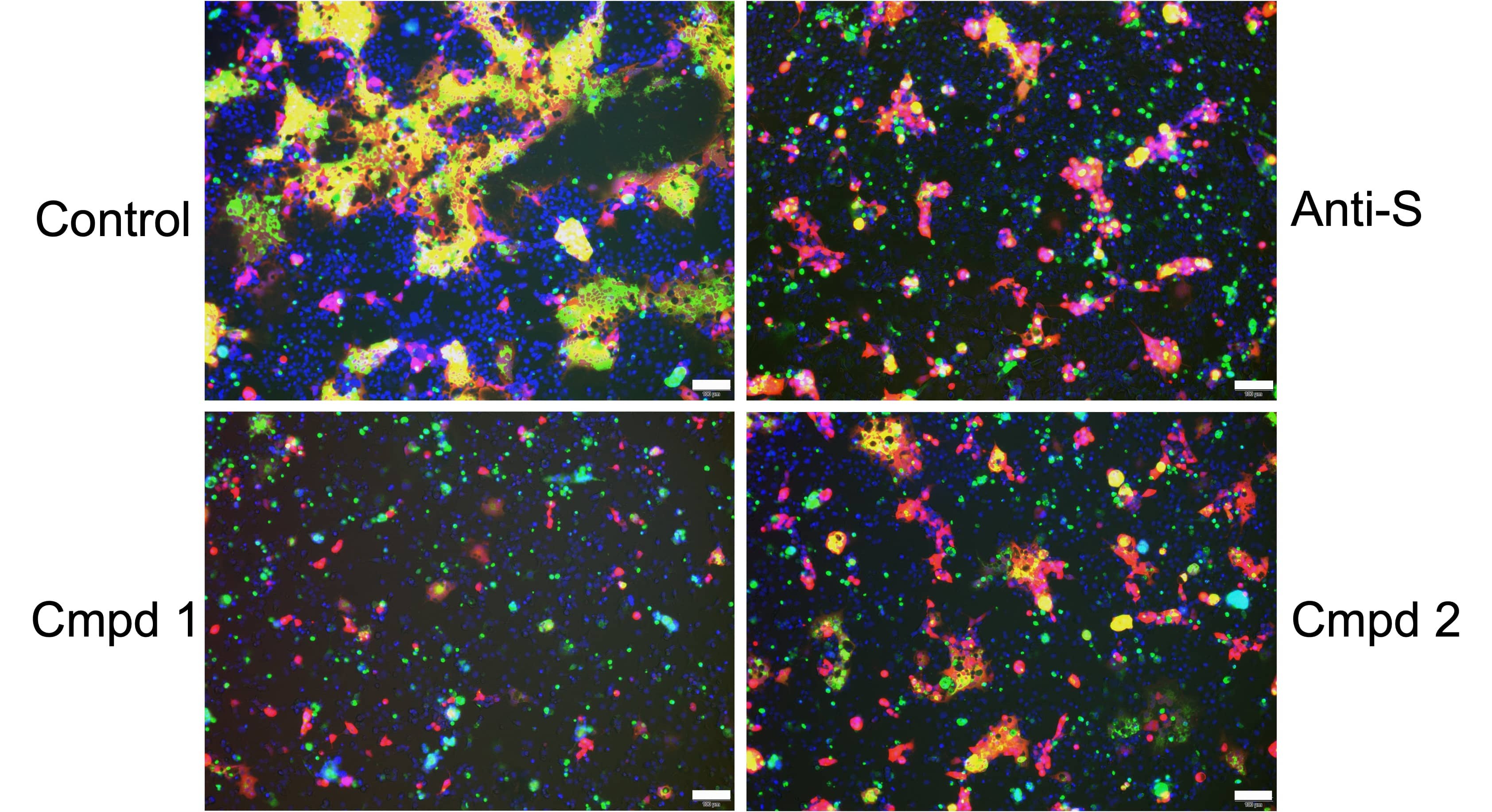 Cell-cell fusion and syncytium formation mediated by SARS-CoV-2 Spike protein.