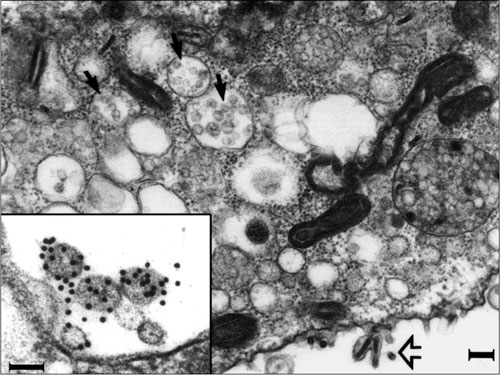 Close up of HCV-like particles.