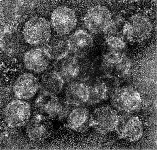 Close-up of HCV-like particles.
