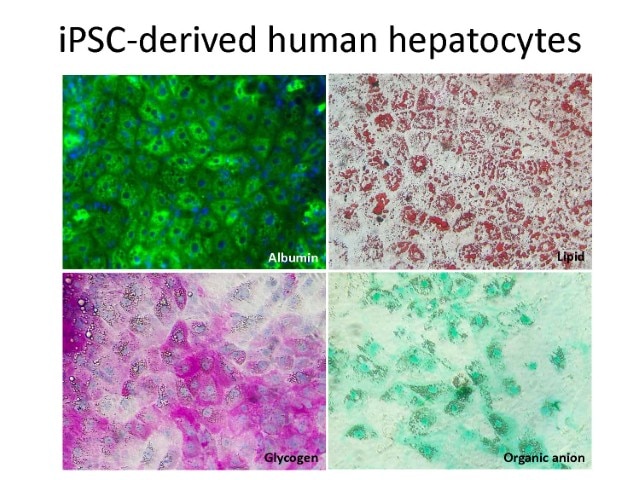 iPSC-derived human hepatocytes.