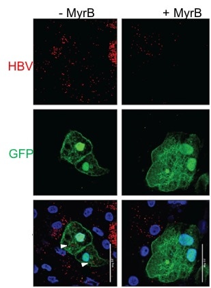 HBV Spread in Cell Culture