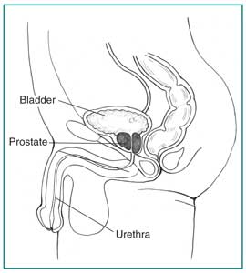 Drawing of the side view of the male urinary tract, with the bladder, prostate, and urethra labeled.