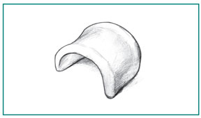 Drawing of a pessary device