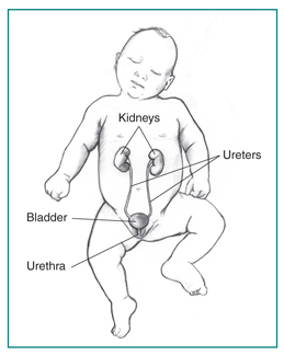 Front-view drawing of a normal urinary tract in an infant. The kidneys, ureters, bladder, and urethra are labeled.