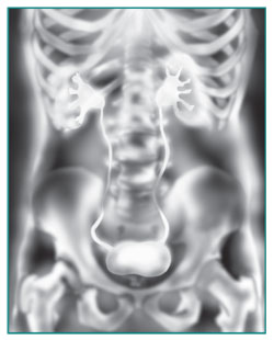 An IVP x ray of the urinary tract showing contrast medium filtering from the blood and passing through the kidneys, down the ureters, into the bladder.