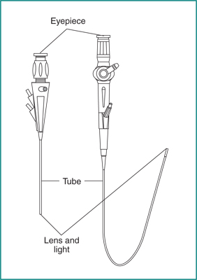 Drawing of a rigid cystoscope and a flexible ureteroscope with eyepieces, tubes, and lenses and light labeled.