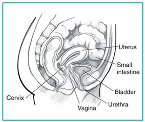 Drawing of a woman’s pelvic area showing the cervix, vagina, urethra, bladder, small intestine, and uterus.
