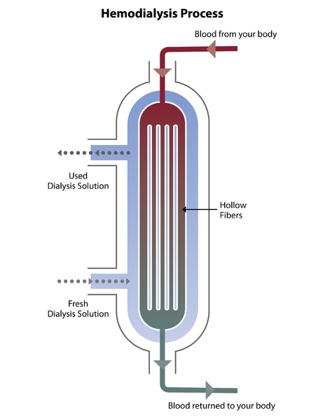 Crossection of a dialyzer showing the hemodyalisis process.