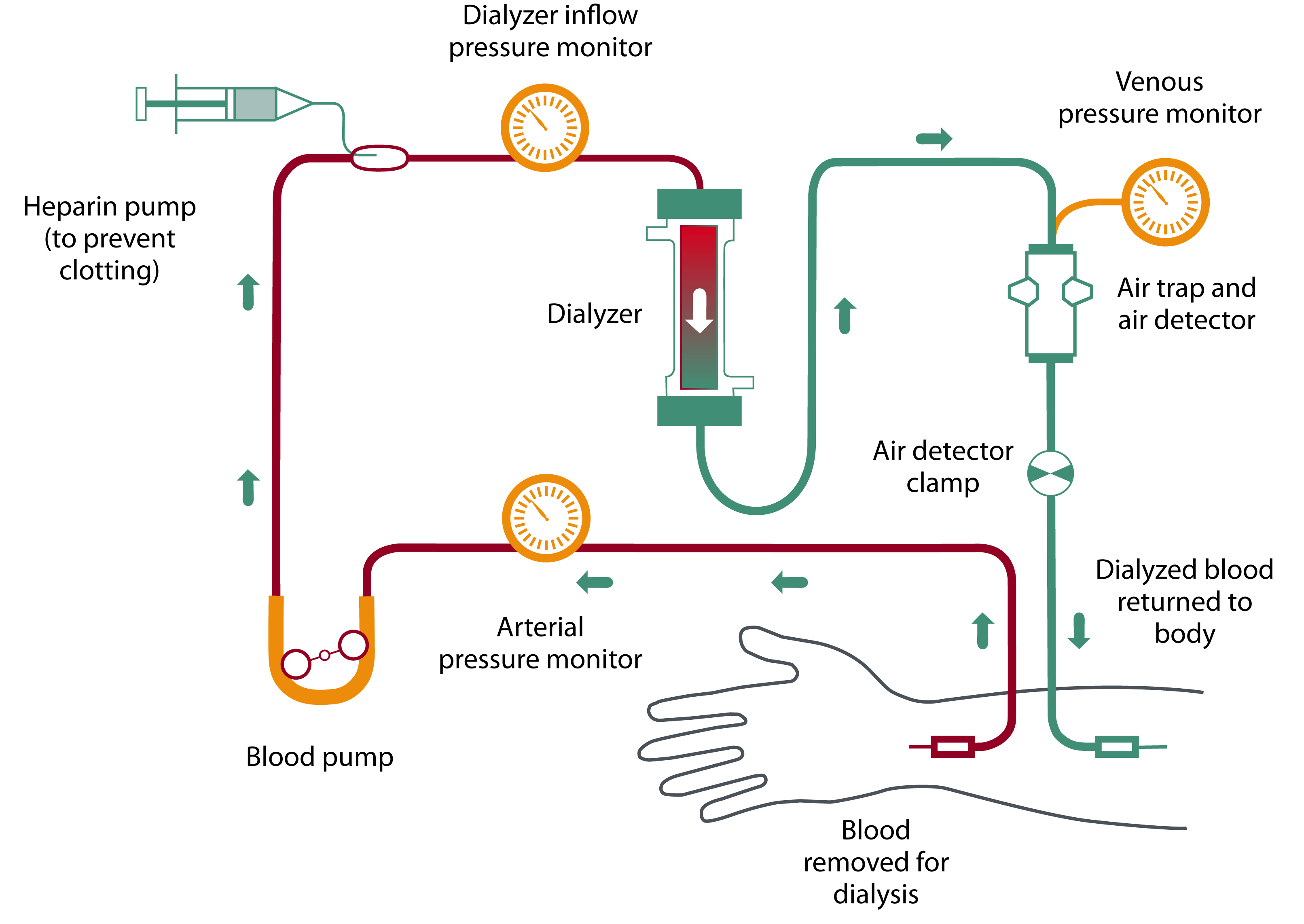 Hemodialysis schematic - Media Asset - NIDDK