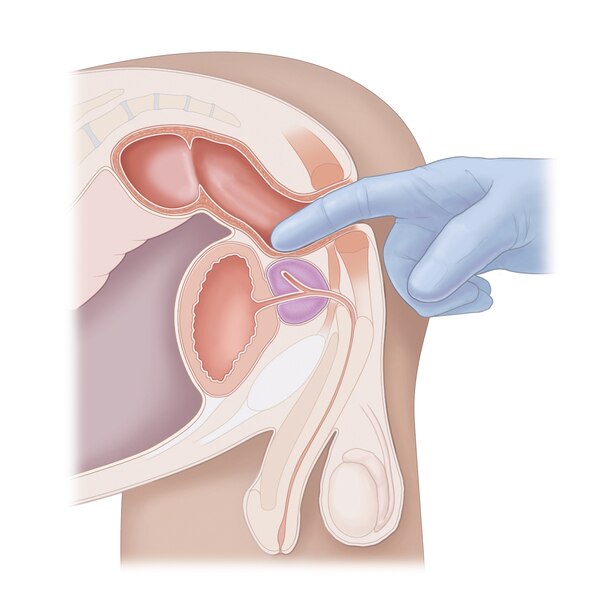 Illustration of a cross-section diagram of a digital rectal exam.