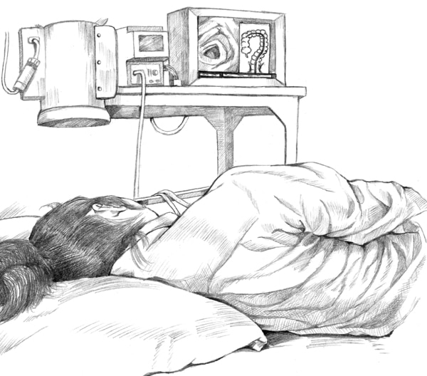 Drawing of a woman being tested for colon polyps. The woman is lying on her left side with her head on a pillow. In the background is a TV screen showing images of the colon.