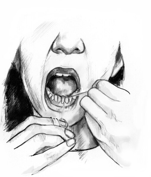 Drawing of a woman flossing her lower teeth.