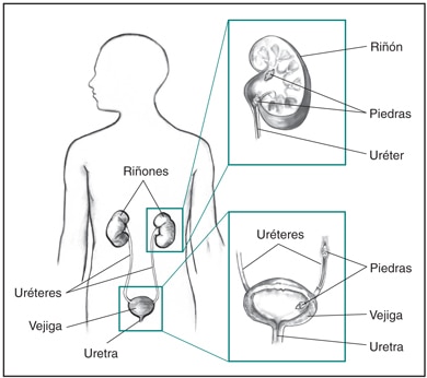 Illustration of the kidneys and prostate with Spanish labels.