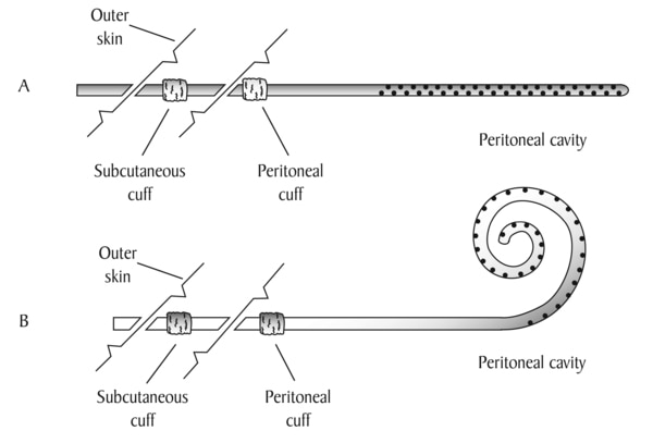 Peritoneal Cavity