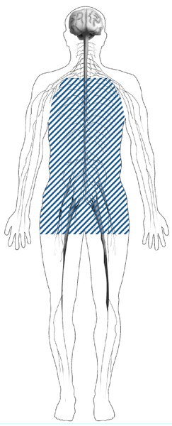 Illustration of a body with shaded lines showing the location of nerves affected by autonomic neuropathy. Autonomic nerves are in the heart, stomach, intestines, bladder, sex organs, sweat glands, eyes, and lungs.