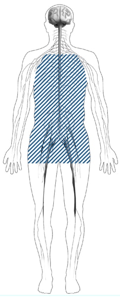 Illustration of a body with shaded lines showing the location of nerves affected by autonomic neuropathy. Autonomic nerves are in the heart, stomach, intestines, bladder, sex organs, sweat glands, eyes, and lungs.