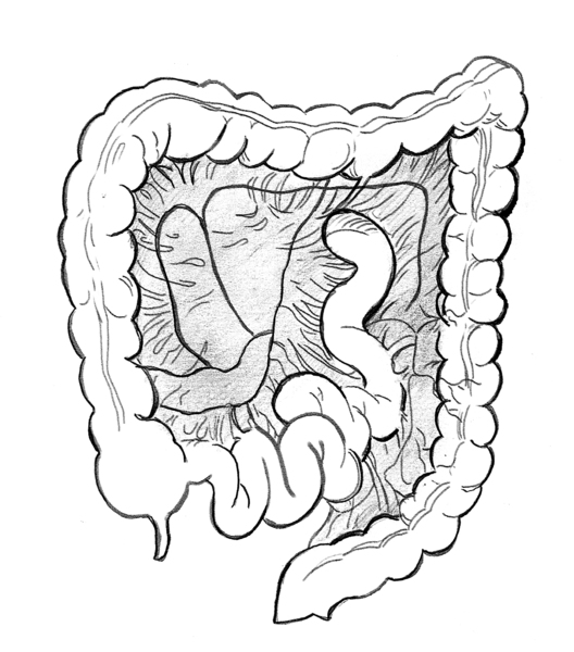 Illustration of the colon and the mesentery, which holds the colon in place.