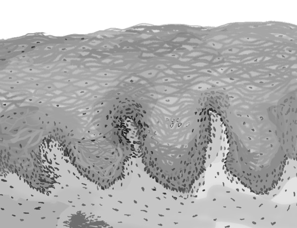 Illustration of a microscopic piece of the esophagus showing normal tissue.