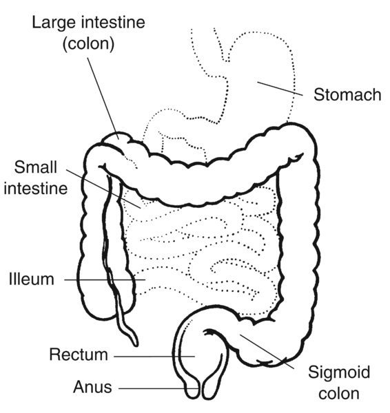 Illustration of the lower digestive tract with labels: stomach, large intestine (colon), small intestine, ileum, sigmoid colon, rectum, and anus.