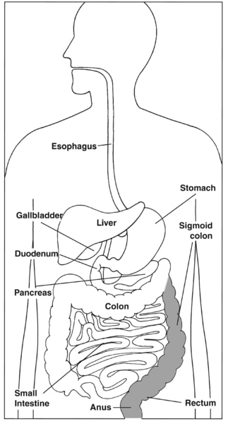 Illustration of the digestive system with sigmoid colon, rectum, and anus highlighted and parts labeled: esophagus, stomach, liver, gallbladder, duodenum, pancreas, small intestine, colon, sigmoid colon, rectum, and anus.
