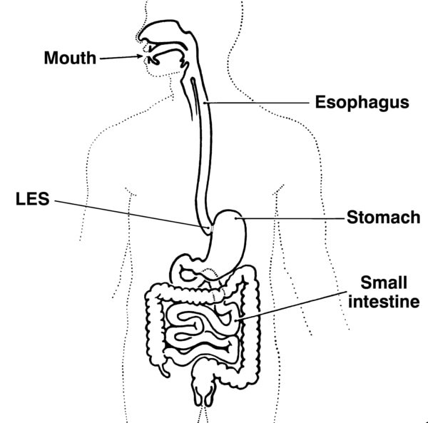 Illustration of the digestive system, with the mouth, esophagus, lower esophageal sphincter (LES), stomach, and small intestine labeled.