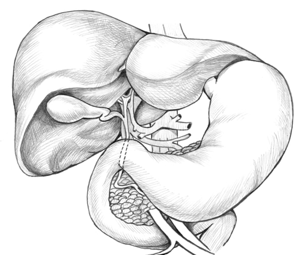 Illustration of the biliary system.
