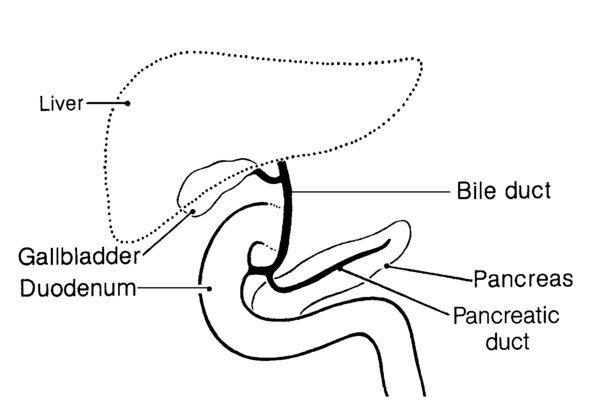 Illustration of the pancreas in relation to other local organs and conduits, with the liver, bile duct, gallbladder, duodenum, pancreas, and pancreatic duct labeled.