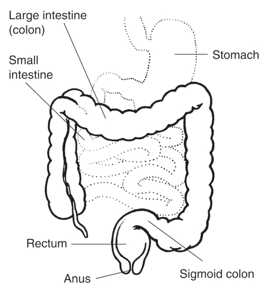 Illustration of the lower digestive tract with stomach, large intestine (colon), small intestine, sigmoid colon, rectum, and anus labeled.