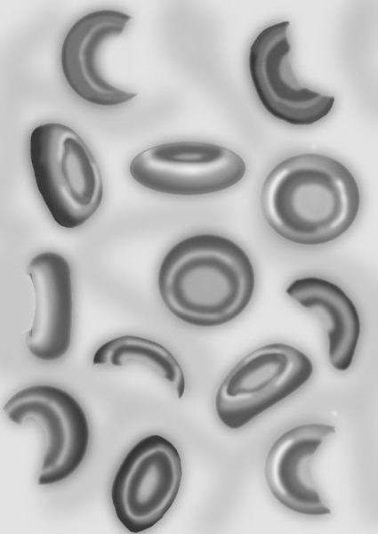 Illustration of broken red blood cells, as seen in the blood of people with hemolytic uremic syndrome.