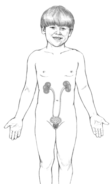 Illustration of the kidneys and urinary tract within the outline of a young boy. The kidneys, ureters, and bladder are labeled.