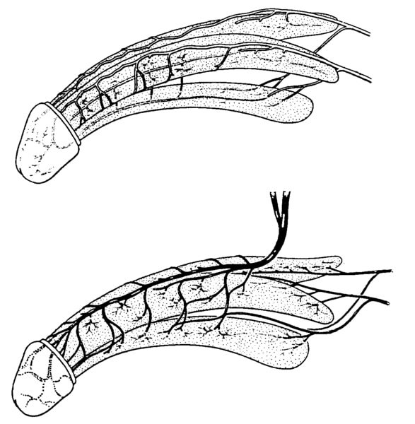 Two illustrations of the penis: the top one showing the arteries of the penis and the bottom one showing the veins of the penis.
