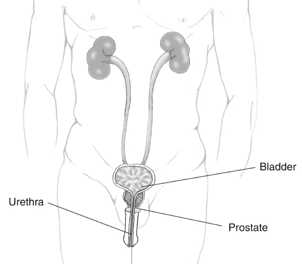Illustration of the male urinary tract with prostate, urethra, and bladder labeled.