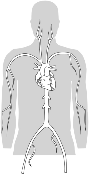 Illustration of an upper torso showing the location of the heart and blood vessels.