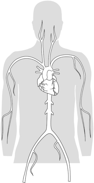 Illustration of an upper torso showing the location of the heart and blood vessels.