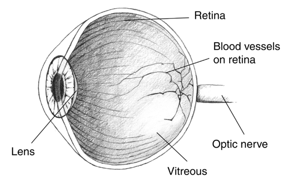 Illustration of an eye cross section with the lens, retina, blood vessels, optic nerve, and vitreous labeled.