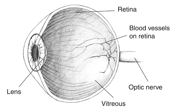 Illustration of an eye cross section with the lens, retina, blood vessels, optic nerve, and vitreous labeled.