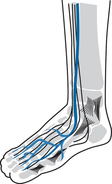 Illustration of a foot.  The nerves are colored in blue while everything else is in black and white.