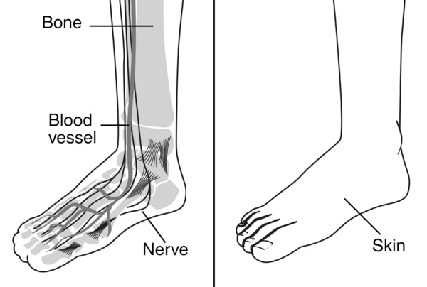Illustration of two diagrams of a foot.  The one on the left shows the bones, blood vessels, and nerves of the foot while the one on the right shows the foot with skin on.