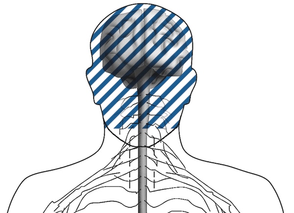 Illustration of a head showing the cranial nerves.