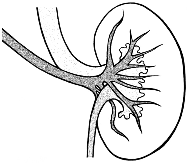 A kidney with connected arteries.