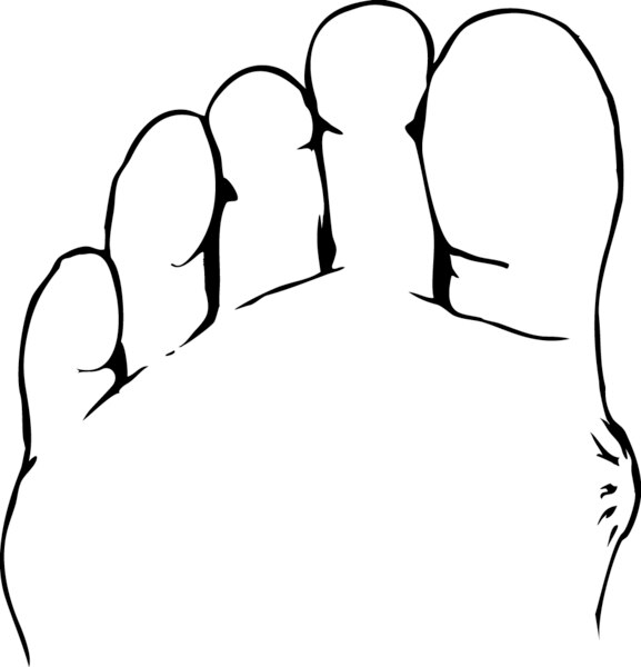 Drawing of a foot with a blister.