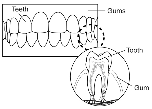 Drawing of teeth, gums, and a single tooth. One part of the drawing is labeled to show teeth and gums. Another part of the drawing is labeled to show a cross-section of a tooth and the gum.