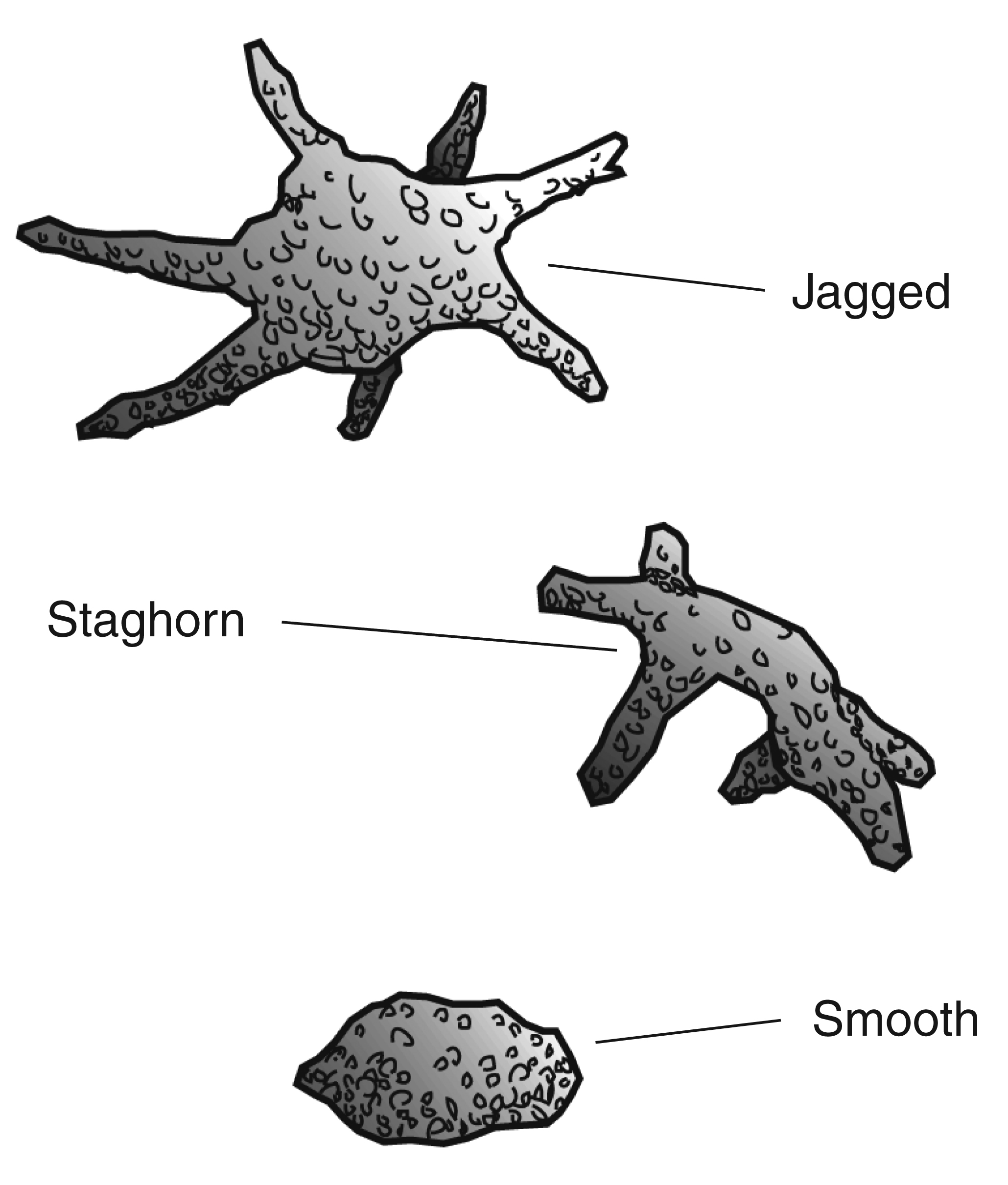 staghorn-kidney-stones