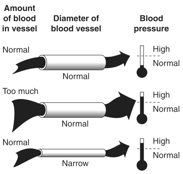 Drawing of blood flowing through a normal blood vessel, blood flowing through a narrowed blood vessel, and too much blood flowing through a normal blood vessel.