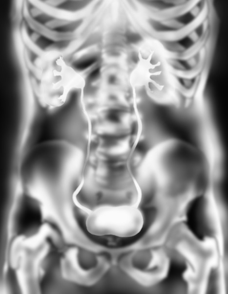 An IVP x ray of the urinary tract showing contrast medium filtering from the blood and passing through the kidneys, down the ureters, into the bladder.