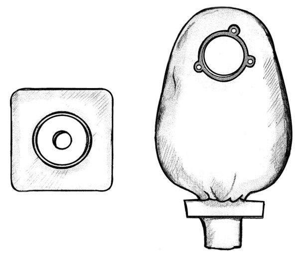 Drawing of a two-piece pouch system for collecting urine through a stoma. The square barrier sticks to the skin and has a hole for the stoma. The pouch attaches to the barrier and has a valve at the bottom for emptying the urine.