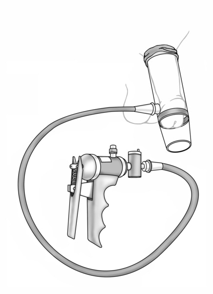 Drawing of a vacuum tube for making an erection.