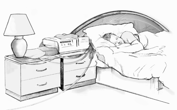 Drawing of peritoneal dialysis cycler.