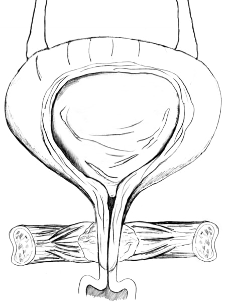 Diagram of front view of female bladder with strong pelvic muscles keeping the urethra closed. The bladder is shown in cross-section to reveal urine in the bladder. Labels point to the bladder neck, strong pelvic muscles, urethral sphincter, and urethra.