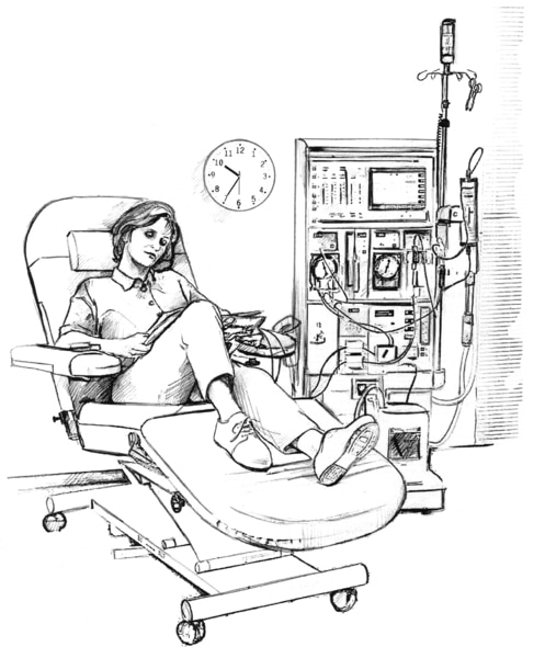 Drawing of a woman receiving hemodialysis treatment in a clinic. A wall clock behind the woman reads 10:35 a.m.